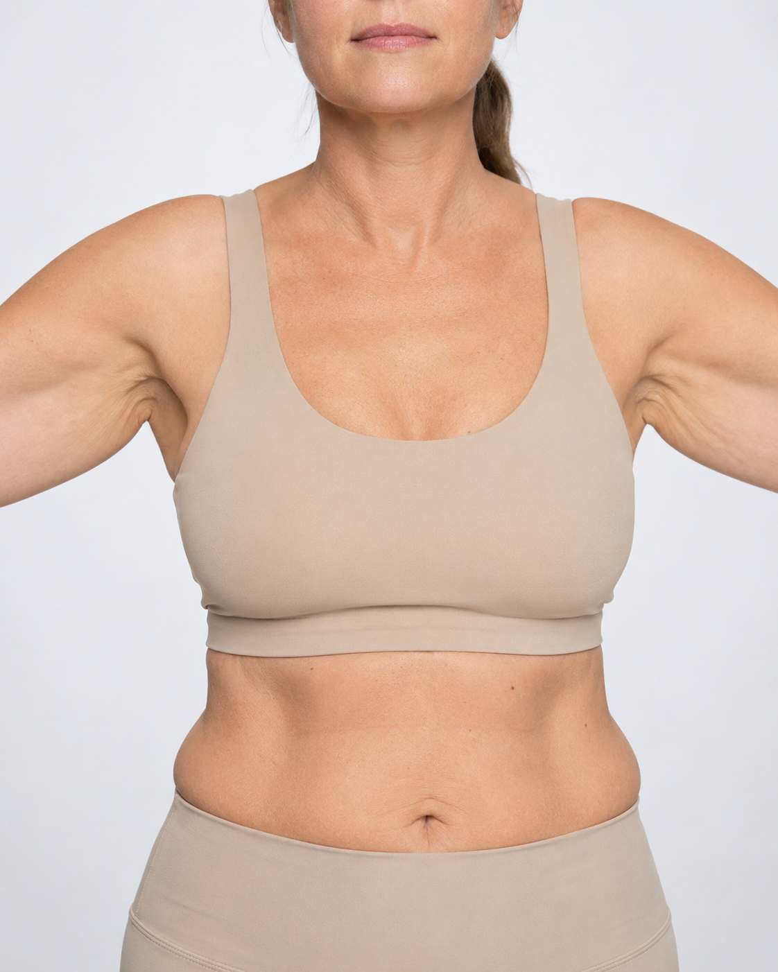 Before brachioplasty arm contouring